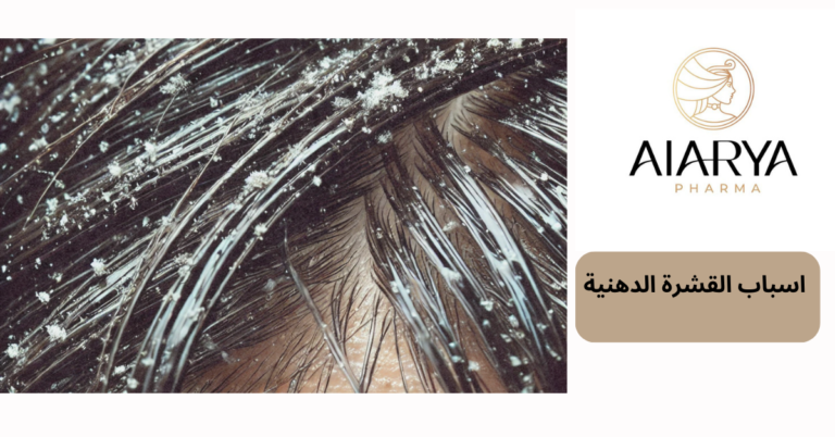 اسباب القشرة الدهنية
