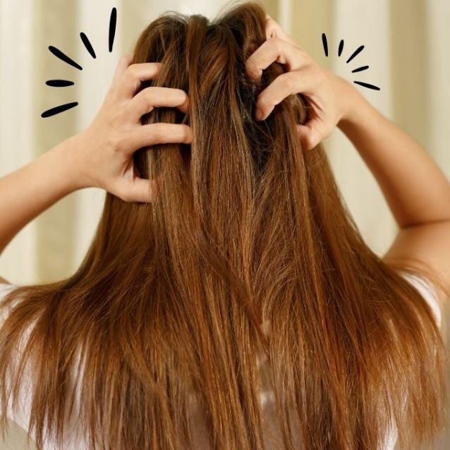 علاج قشرة الشعر في الشتاء