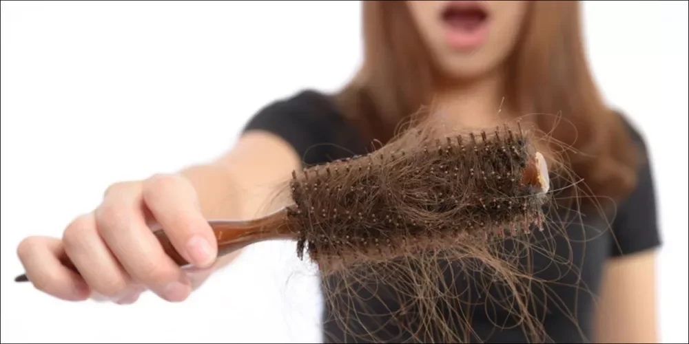 تساقط الشعر في الشتاء